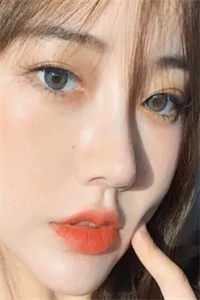 车祸当时没事第二天脖子疼